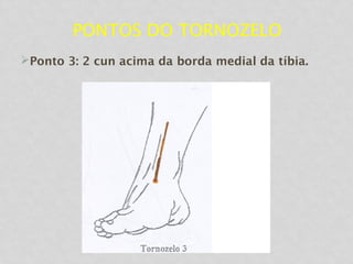 PONTOS DO TORNOZELO
Ponto 3: 2 cun acima da borda medial da tíbia.
 