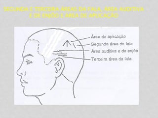 SEGUNDA E TERCEIRA ÁREAS DA FALA, ÁREA AUDITIVA
E DE ENJÔO E ÁREA DE APLICAÇÃO
 