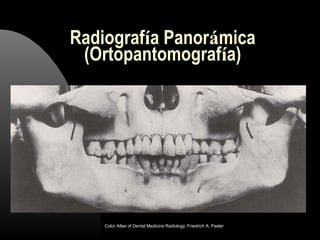 Radiografía Panorámica
(Ortopantomografía)
Color Atlas of Dental Medicine Radiology, Friedrich A. Pasler
 