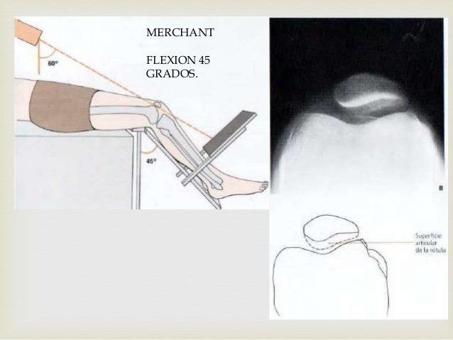 tcnicas y proyecciones muslo y rodilla 20 638