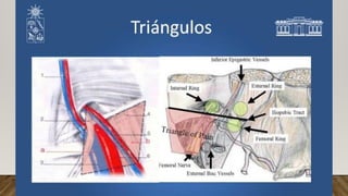 Técnica TAPP (Transabdominal Preperitoneal). Formato residencia pptx | PPTX