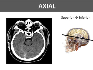 AXIAL
Superior à Inferior
AXIAL
 
