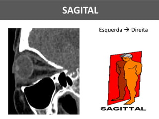 Esquerda à Direita
SAGITAL
 