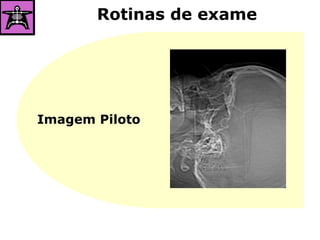 Rotinas de exame
Imagem Piloto
 