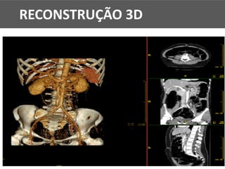 RECONSTRUÇÃO 3D
 