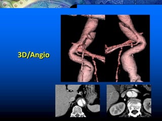 3D/Angio
 