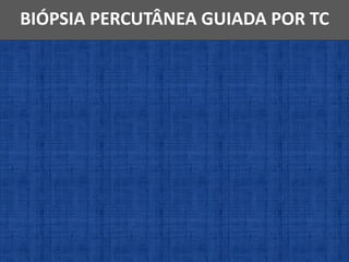 BIÓPSIA PERCUTÂNEA GUIADA POR TC
 