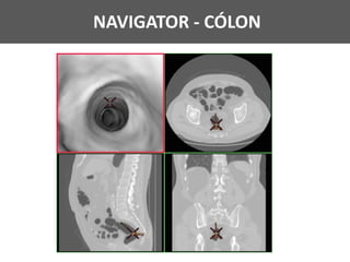 NAVIGATOR - CÓLON
 