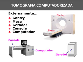 § Gantry
§ Mesa
§ Gerador
§ Console
§ Computador
Externamente...
Mesa
Gantry
Console
Computador
Gerador
TOMOGRAFIA COMPUTADORIZADA
 