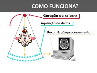 Recon & pós-processamento
Aquisição de dados
Geração de raios-x
COMO FUNCIONA?
 