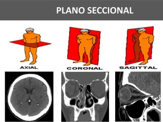 1° PASSO: PLANOS SECCIONAISPLANO SECCIONAL
 
