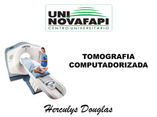 TOMOGRAFIA
COMPUTADORIZADA
Herculys Douglas
 