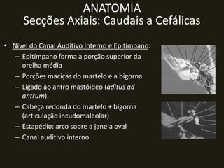 ANATOMIA
      Secções Axiais: Caudais a Cefálicas
• Nível do Canal Auditivo Interno e Epitímpano:
   – Epitímpano forma a porção superior da
     orelha média
   – Porções maciças do martelo e a bigorna
   – Ligado ao antro mastóideo (aditus ad
     antrum).
   – Cabeça redonda do martelo + bigorna
     (articulação incudomaleolar)
   – Estapédio: arco sobre a janela oval
   – Canal auditivo interno
 
