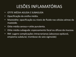 LESÕES INFLAMATÓRIAS
• OTITE MÉDIA AGUDA E SUBAGUDA
• Opacificação da orelha média.
• Mastoidite: opacificação ou níveis de fluido nas células aéreas da
  mastoide.
• Otite média serosa ≠ otite purulenta.
• Otite média subaguda: espessamento focal ou difuso da mucosa.
• RM: sugere complicações intracranianas (abscesso epidural,
  empiema subdural, trombose do seio sigmoide)
 