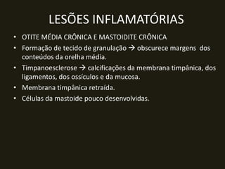 LESÕES INFLAMATÓRIAS
• OTITE MÉDIA CRÔNICA E MASTOIDITE CRÔNICA
• Formação de tecido de granulação  obscurece margens dos
  conteúdos da orelha média.
• Timpanoesclerose  calcificações da membrana timpânica, dos
  ligamentos, dos ossículos e da mucosa.
• Membrana timpânica retraída.
• Células da mastoide pouco desenvolvidas.
 
