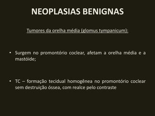 NEOPLASIAS BENIGNAS
       Tumores da orelha média (glomus tympanicum):



• Surgem no promontório coclear, afetam a orelha média e a
  mastóide;



• TC – formação tecidual homogênea no promontório coclear
  sem destruição óssea, com realce pelo contraste
 