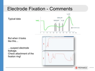 Electrode Fixation - Comments
But when it looks
like this…
…suspect electrode
leakage.
Check attachment of the
fixation ring!
Typical data
 
