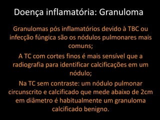 Doença inflamatória: Granuloma
  Granulomas pós inflamatórios devido à TBC ou
infecção fúngica são os nódulos pulmonares mais
                       comuns;
    A TC com cortes finos é mais sensível que a
  radiografia para identificar calcificações em um
                       nódulo;
    Na TC sem contraste: um nódulo pulmonar
circunscrito e calcificado que mede abaixo de 2cm
   em diâmetro é habitualmente um granuloma
                calcificado benigno.
 