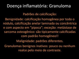 Doença inflamatória: Granuloma
               Padrões de calcificação:
  Benignidade: calcificação homogênea por todo o
nódulo, calcificação anelar laminada ou concêntrica
e com aspecto em “pipoca”; exceção: metástase de
 sarcoma osteogênico: são tipicamente calcificadas
             com padrão homogêneo!!
         Malignidade: padrões diferentes.
 Granulomas benignos inativos: pouco ou nenhum
           realce pelo meio de contraste.
 