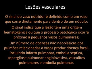 Lesões vasculares
 O sinal do vaso nutridor é definido como um vaso
que corre diretamente para dentro de um nódulo;
     O sinal indica que a lesão tem uma origem
hematogênica ou que o processo patológico ocorre
      próximo a pequenos vasos pulmonares;
   Um número de doenças não neoplásicas dos
pulmões relacionadas a vasos produz doença focal,
    incluindo infarto pulmonar, embolia séptica,
  aspergilose pulmonar angioinvasiva, vasculites
          pulmonares e embolia pulmonar.
 