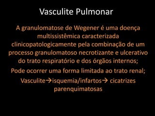 Vasculite Pulmonar
   A granulomatose de Wegener é uma doença
           multissistêmica caracterizada
 clinicopatologicamente pela combinação de um
processo granulomatoso necrotizante e ulcerativo
    do trato respiratório e dos órgãos internos;
 Pode ocorrer uma forma limitada ao trato renal;
     Vasculiteisquemia/infartos cicatrizes
                 parenquimatosas
 