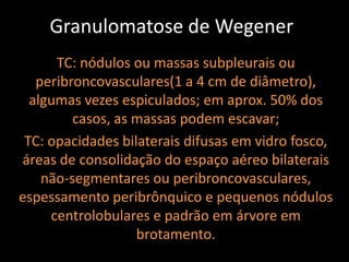 Granulomatose de Wegener
      TC: nódulos ou massas subpleurais ou
   peribroncovasculares(1 a 4 cm de diâmetro),
  algumas vezes espiculados; em aprox. 50% dos
         casos, as massas podem escavar;
 TC: opacidades bilaterais difusas em vidro fosco,
áreas de consolidação do espaço aéreo bilaterais
    não-segmentares ou peribroncovasculares,
espessamento peribrônquico e pequenos nódulos
     centrolobulares e padrão em árvore em
                   brotamento.
 