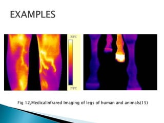 Fig 12,MedicalInfrared Imaging of legs of human and animals(15)
 