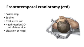 TRANSCRANIAL SURGERY FOR PITUITARY MACROADENOMA.pptx