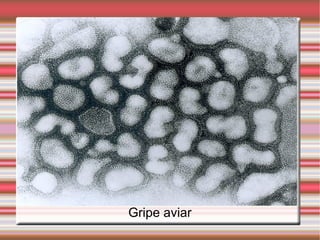 Gripe aviar 