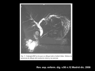 Rev. esp. enferm. dig. v.98 n.12 Madrid dic. 2006
 
