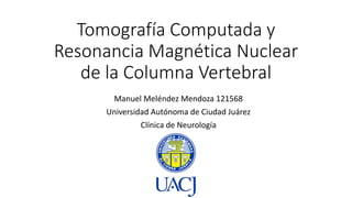 Tomografía Computada y
Resonancia Magnética Nuclear
de la Columna Vertebral
Manuel Meléndez Mendoza 121568
Universidad Autónoma de Ciudad Juárez
Clínica de Neurología
 