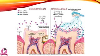 https://desmineralizacaod.wordpress.com/2011/06/09/desmineralizacao-e-mineralizacao-2/
 