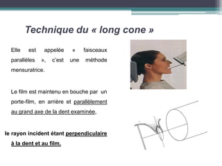 Technique du « long cone »
Elle est appelée « faisceaux
parallèles », c’est une méthode
mensuratrice.
Le film est maintenu en bouche par un
porte-film, en arrière et parallèlement
au grand axe de la dent examinée,
le rayon incident étant perpendiculaire
à la dent et au film.
 
