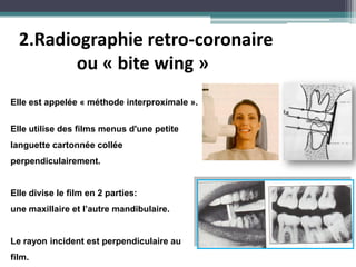 2.Radiographie retro-coronaire
ou « bite wing »
Elle est appelée « méthode interproximale ».
Elle utilise des films menus d'une petite
languette cartonnée collée
perpendiculairement.
Elle divise le film en 2 parties:
une maxillaire et l’autre mandibulaire.
Le rayon incident est perpendiculaire au
film.
 