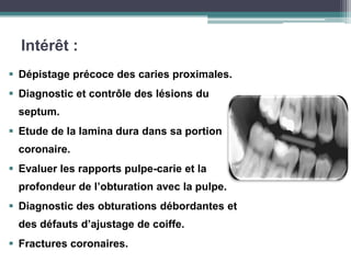Intérêt :
 Dépistage précoce des caries proximales.
 Diagnostic et contrôle des lésions du
septum.
 Etude de la lamina dura dans sa portion
coronaire.
 Evaluer les rapports pulpe-carie et la
profondeur de l’obturation avec la pulpe.
 Diagnostic des obturations débordantes et
des défauts d’ajustage de coiffe.
 Fractures coronaires.
 
