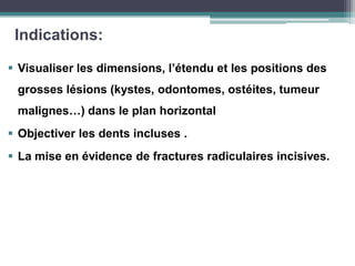 Indications:
 Visualiser les dimensions, l’étendu et les positions des
grosses lésions (kystes, odontomes, ostéites, tumeur
malignes…) dans le plan horizontal
 Objectiver les dents incluses .
 La mise en évidence de fractures radiculaires incisives.
 