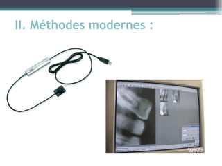 II. Méthodes modernes :
 