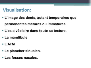  L’image des dents, autant temporaires que
permanentes matures ou immatures.
 L’os alvéolaire dans toute sa texture.
 La mandibule
 L’ATM
 Le plancher sinusien.
 Les fosses nasales.
Visualisation:
 