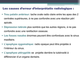 Les causes d’erreur d’interprétatio radiologique :
 Trou palatin antérieur: tache ovale radio claire entre les apex des 2
centrales supérieures, à ne pas confondre avec une réaction péri
apicale.
 Dépression latérale plus sombre que les autres régions, à ne pas
confondre avec une raréfaction osseuse.
 Les fosses nasales énormes peuvent être confondues avec le sinus
maxillaire.
 L’apophyse zygomatique: radio opaque peut être projetée à
l’intérieur du sinus.
 L’apophyse ptérygoïde se projette derrière la tubérosité à
différencier d’un organe dentaire.
 