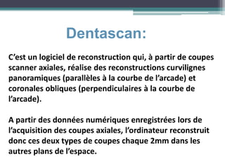 Dentascan:
C’est un logiciel de reconstruction qui, à partir de coupes
scanner axiales, réalise des reconstructions curvilignes
panoramiques (parallèles à la courbe de l’arcade) et
coronales obliques (perpendiculaires à la courbe de
l’arcade).
A partir des données numériques enregistrées lors de
l’acquisition des coupes axiales, l’ordinateur reconstruit
donc ces deux types de coupes chaque 2mm dans les
autres plans de l’espace.
 