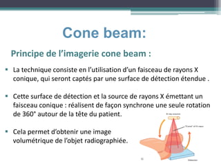 Cone beam:
Principe de l’imagerie cone beam :
 La technique consiste en l’utilisation d’un faisceau de rayons X
conique, qui seront captés par une surface de détection étendue .
 Cette surface de détection et la source de rayons X émettant un
faisceau conique : réalisent de façon synchrone une seule rotation
de 360° autour de la tête du patient.
 Cela permet d’obtenir une image
volumétrique de l’objet radiographiée.
 