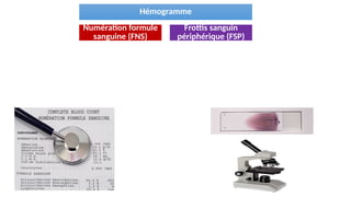 Hémogramme
Numération formule
sanguine (FNS)
Frottis sanguin
périphérique (FSP)
 