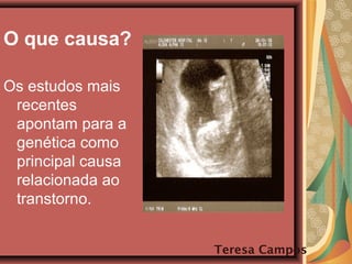 O que causa?
Os estudos mais
recentes
apontam para a
genética como
principal causa
relacionada ao
transtorno.
Teresa Campos
 