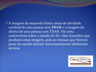 A imagem da esquerda ilustra áreas de atividade cerebral de uma pessoa sem  TDAH  e a imagem da direita de uma pessoa com TDAH. Há certa controvérsia sobre o estudo do Dr. Alan Zametkin que produziu estas imagens, pois as crianças que fizeram parte do estudo tinham maioritariamente disfunções severas. 
