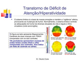 Dr. Cláudio Costa
Transtorno de Déficit de
Atenção/Hiperatividade
 O sistema límbico é a base de nossas emoções e mantém a “vigilância” afetiva,
provocando as mudanças de humor. Normalmente, o sistema límbico controla
as adequações do humor às diversas situações da vida e regula o ritmo
circadiano (ciclo sono/vigília).
A figura ao lado apresenta Mapeamentos
Cerebrais de duas crianças com TDA/H
comparados com os dois controles.
Os portadores apresentam excesso de
ondas lentas (ondas theta e alfa)
comparadas aos controles. Isso indica
um falta de controle no córtex.
 