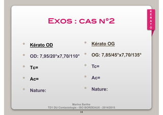 Marina Barthe 
TD1 DU Contactologie - ISO BORDEAUX - 2014/2015 
14 
K 
E 
R 
A 
T 
O 
Exos : cas n°2! 
• Kérato OD 
• OD: 7,95/20°x7,70/110° 
• Tc= 
• Ac= 
• Nature: 
• Kérato OG 
• OG: 7,85/45°x7,70/135° 
• Tc= 
• Ac= 
• Nature: 
 
