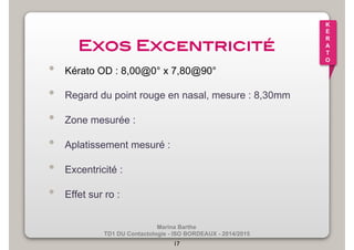 Marina Barthe 
TD1 DU Contactologie - ISO BORDEAUX - 2014/2015 
17 
K 
E 
R 
A 
T 
O 
Exos Excentricité! 
• Kérato OD : 8,00@0° x 7,80@90° 
• Regard du point rouge en nasal, mesure : 8,30mm 
• Zone mesurée : 
• Aplatissement mesuré : 
• Excentricité : 
• Effet sur ro : 
 