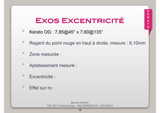 Marina Barthe 
TD1 DU Contactologie - ISO BORDEAUX - 2014/2015 
19 
K 
E 
R 
A 
T 
O 
Exos Excentricité! 
• Kérato OG : 7,85@45° x 7,60@135° 
• Regard du point rouge en haut à droite, mesure : 8,10mm 
• Zone mesurée : 
• Aplatissement mesuré : 
• Excentricité : 
• Effet sur ro : 
 