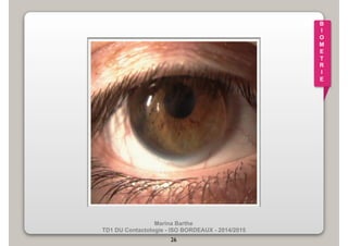 Marina Barthe 
TD1 DU Contactologie - ISO BORDEAUX - 2014/2015 
26 
B 
I 
O 
M 
E 
T 
R 
I 
E 
 