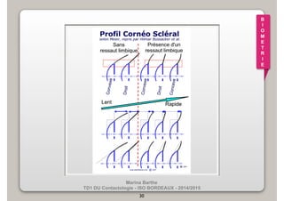 Marina Barthe 
TD1 DU Contactologie - ISO BORDEAUX - 2014/2015 
30 
B 
I 
O 
M 
E 
T 
R 
I 
E 
 